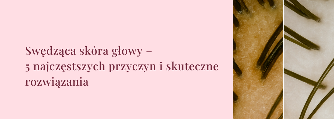 Swędząca skóra głowy – 5 najczęstszych przyczyn i rozwiązania - HollywoodHair