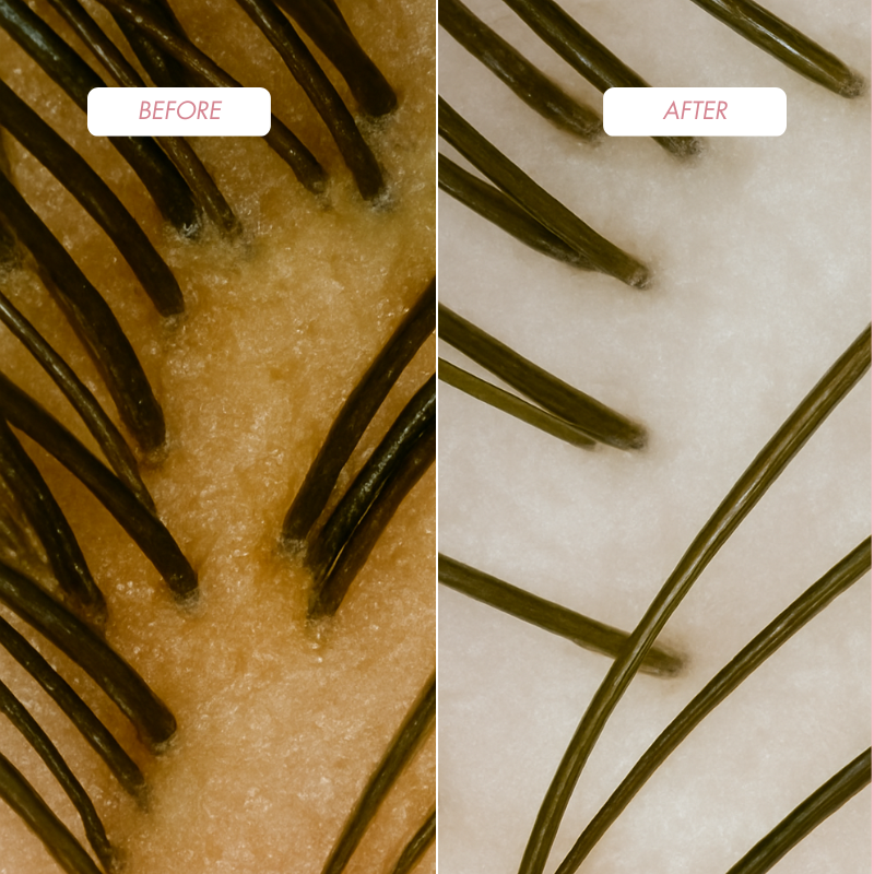 ProHair Reset & Repair (Peeling + Maska)