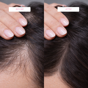 Hair Growth Stimulating Lotion | ProHair 100 ml